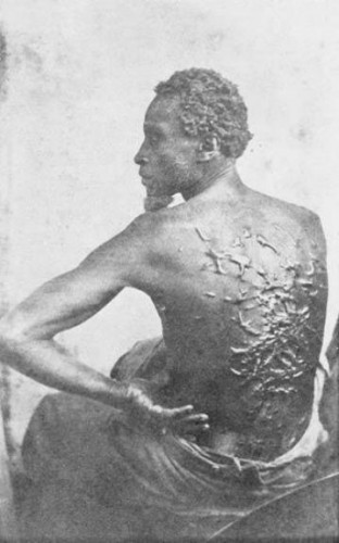 The Scourged Back: This slave named Gordon ran for 80 miles to join the Union Forces in Baton Rouge, Louisiana, in March 1863. This famous photo of the welts on his badly "scourged back" was taken while he was being fitted for a uniform.