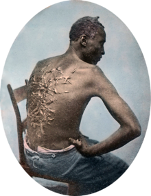 The famous "Scourged Back" photo of fugitive slave Gordon. (Antique colored slide of Gordon during his 1863 medical examination by Union doctors.) This photo was widely disseminated by abolitionists to show the inhumanity of slavery.