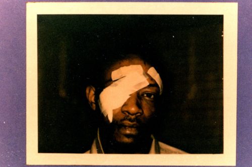 Andrew Wilson, victim of torture by Chicago Police Dept., taken while in custody. Courtesy of the Chicago Torture Archive.