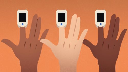 221206112315-20221206-oximeter-inaccuracy-illustration Research suggests pulse oximeters may not work as well on people with dark skin tones. (Will Mullery/CNN)