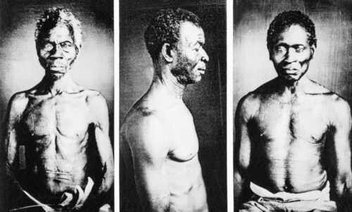 Photographs of enslaved people in the US, possibly the oldest known in the country, were discovered in the basement of a Harvard University museum in 1977. (Bettmann Archive)