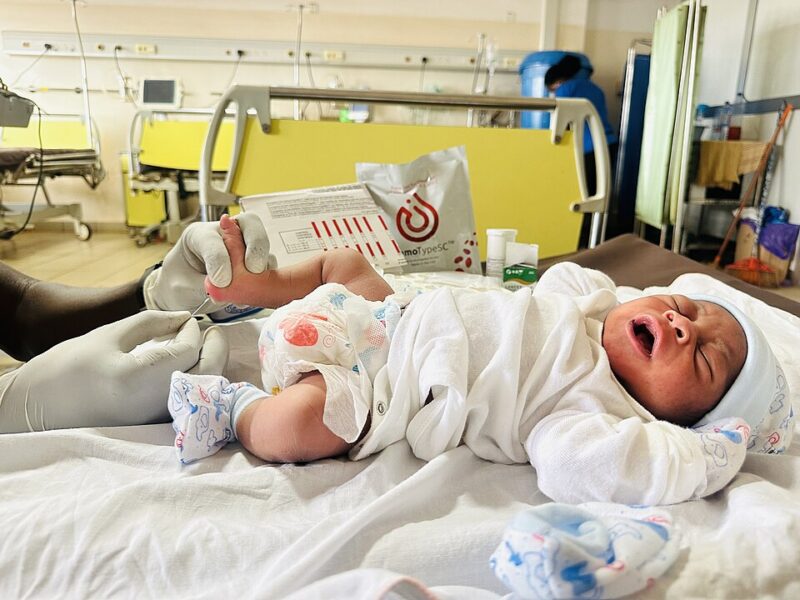 Newborn Screening for sickle cell disease using HemoTypeSC rapid test kit. (Ibrahim Achiri, Wikimedia)