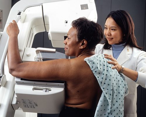 People from Black, Asian and mixed backgrounds 33% less likely to be diagnosed with breast cancer via routine screening. (Rhoda Baer, Wikimedia)